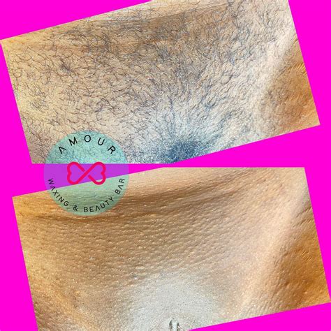 brazilian wax hoorn|Ladies' Waxing near Hoorn, Noord.